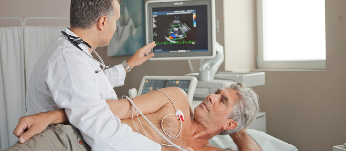 Ecocardiogramma da stress roma clinica sanatrix ECG